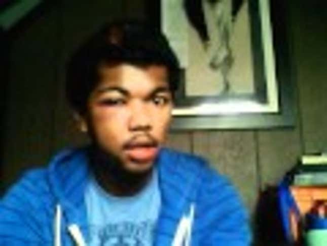 Because Nobody Listened, a Gay-Bashing Victim Takes His Story to YouTube