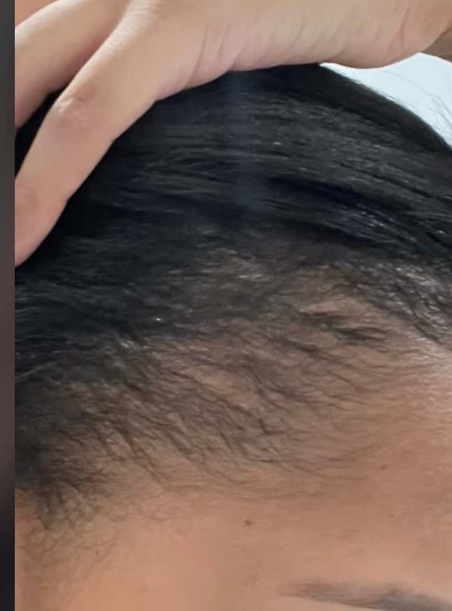 Image for article titled Black Women Are Using This Unusual Male Product to Regrow Their &#39;Edges&#39;