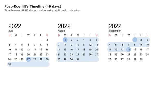 Image for article titled South Carolina Woman Was Forced to Carry Unviable Fetus for 49 Days