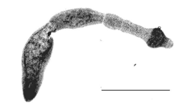 An adult Echinococcus multilocularis tapeworm isolated from a fox in Hungary.