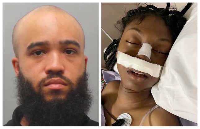 Image for article titled See What This Grown Man Allegedly Did to Hospitalize a 15-Year-Old Black McDonald&#39;s Employee
