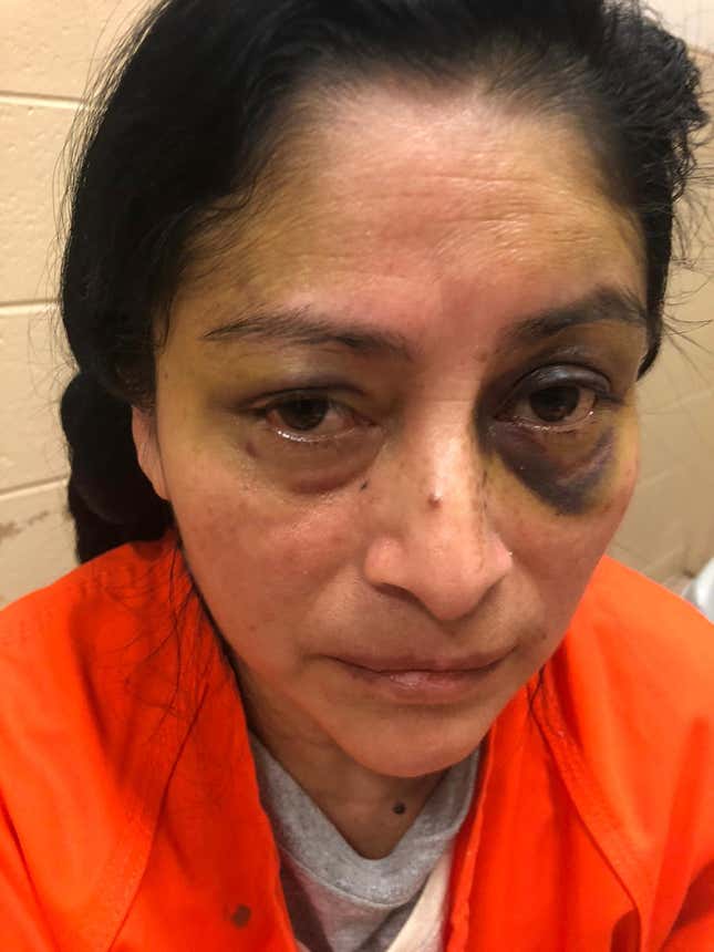 Image for article titled Trump-Supporting Woman Cop in NJ Still on the Job After a Decade of Excessive Force Complaints