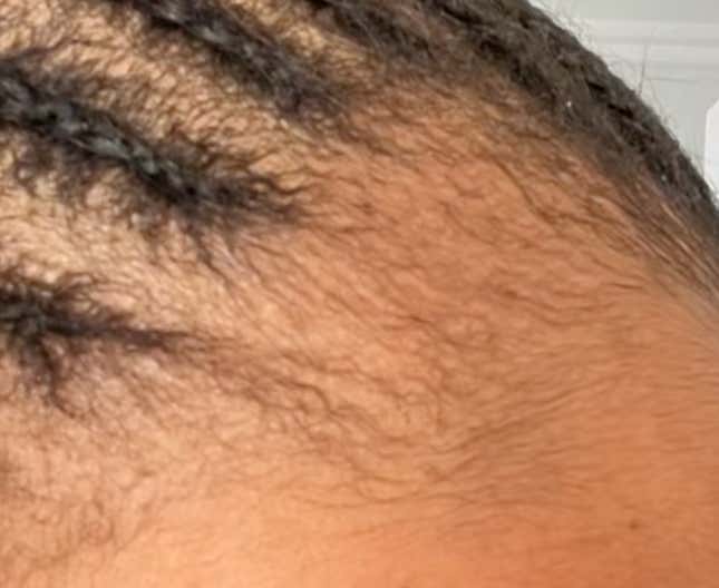 Image for article titled Black Women Are Using This Unusual Male Product to Regrow Their &#39;Edges&#39;