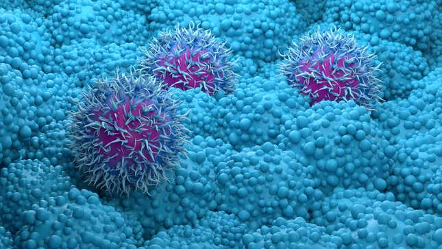 A 3D illustration of pancreatic cancer cells.