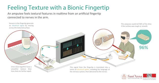 Thanks To A Bionic Fingertip, Amputees Can Feel Textures Again