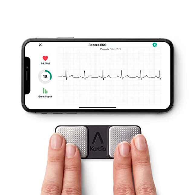 EKG Anywhere, Anytime