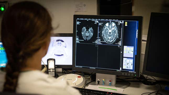 A neurologist examining an MRI. 