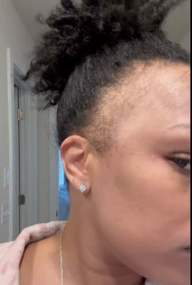 Image for article titled Black Women Are Using This Unusual Male Product to Regrow Their &#39;Edges&#39;