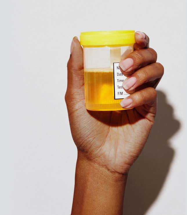 Image for article titled Toni Braxton's Life-Saving Advice for People Living With Lupus