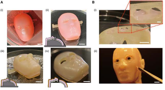 Demonstration of the perforation-type anchors to cover the facial device with skin equivalent