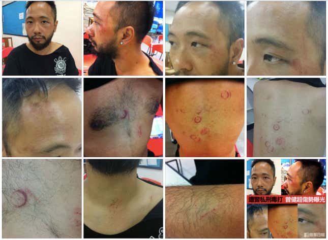 Image for article titled The brutal beating of a Hong Kong protester puts the city’s famed “rule of law” on trial