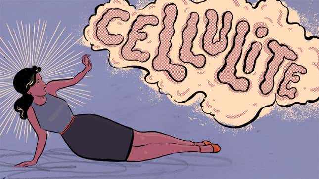 Image for article titled Ladies, Take Cover: 'Pre-Cellulite' Is Coming for You