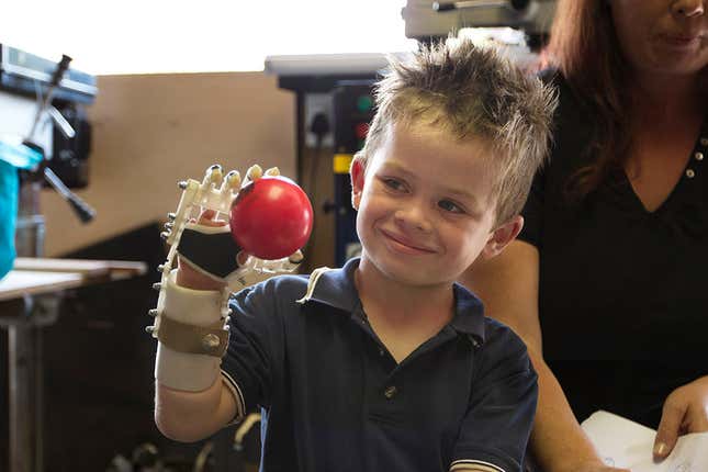 3d printed hand