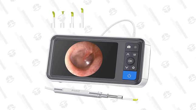 Digital Otoscope | $60 | Amazon