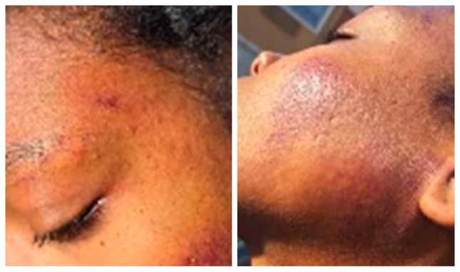 Image for article titled Woman Punched by Charlotte Police in Viral Video Speaks Out
