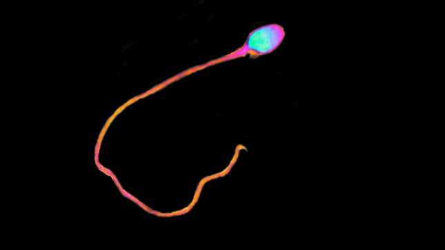 A lone mobile sperm cell, or spermatozoon.