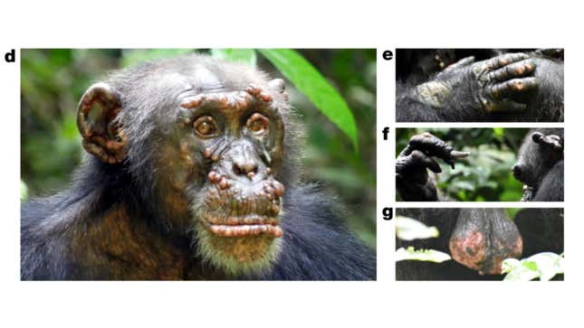 Clinical signs of leprosy in an adult male chimpanzee named Woodstock can be seen along his face, hands, and scrotum. 