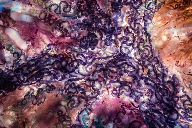 Zooids: Faces of Tiny Warriors