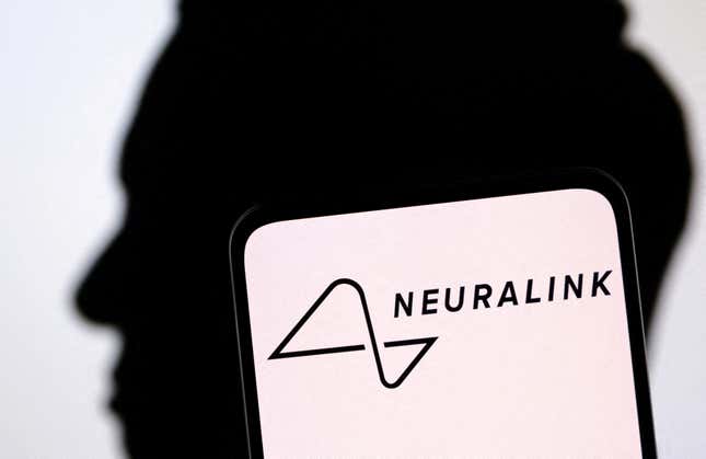 Imagen para el artículo titulado 🌏 ¿Neuralink o Chinalink?