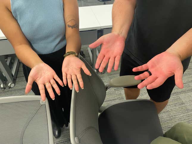 The clap-burned hands of Jezebel staff writer Rodlyn-mae Banting (left) and and G/O video editor Matt Modzelewski (right).