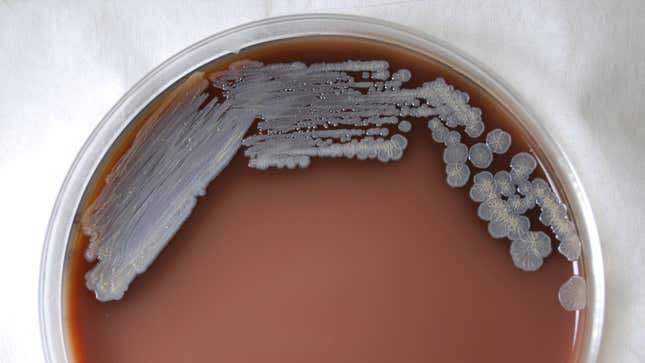 A photo of Burkholderia pseudomallei cultured in chocolate agar after three days time