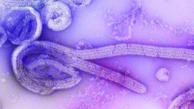 Ab electron microscopic image of the Marburg virus.