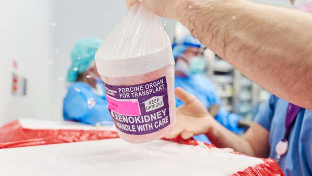 The gene-edited pig kidney with thymus is removed from its transport container to be prepared for transplantation