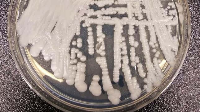 A strain of Candida auris cultured in a petri dish at a CDC laboratory.
