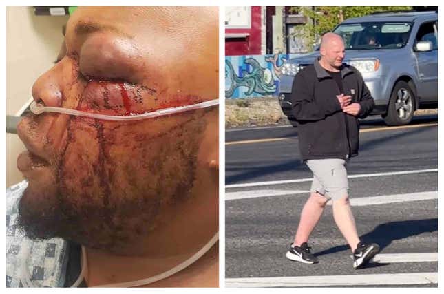 Image for article titled Graphic Images: Vicious Racist Attack of Portland Man Sparks Investigation