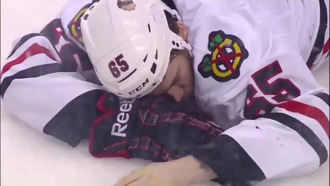 Andrew Shaw Took A Puck To The Face