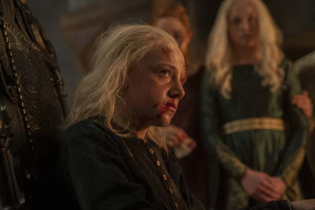Young Aemond (Leo Ashton) 