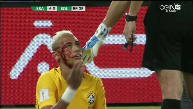 Neymar Is Bleeding Profusely