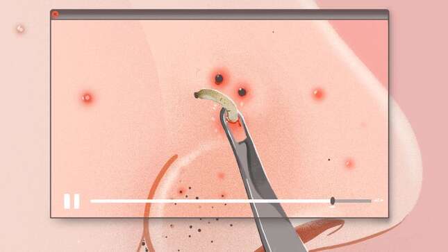 When Your Skin Condition Becomes Viral Content