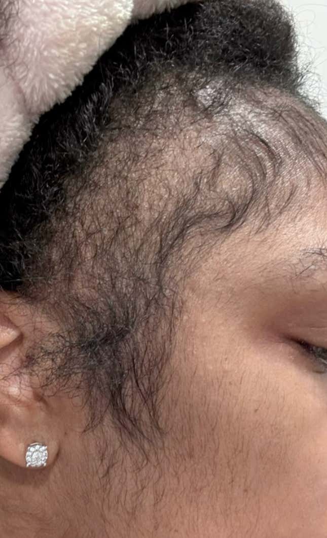 Image for article titled Black Women Are Using This Unusual Male Product to Regrow Their &#39;Edges&#39;