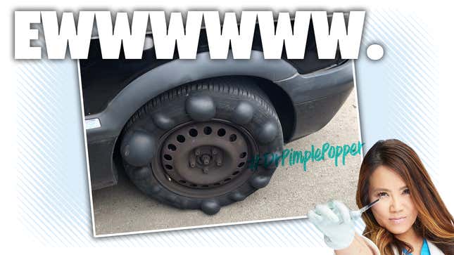 Image for article titled British Police Officer Stops Car With A Tire That Looks Like It Has Black Plague Or Some Shit