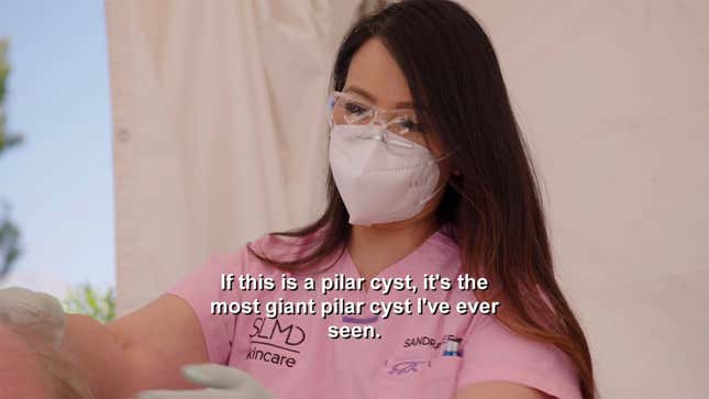 Image for article titled That's the Way the Pilar Cyst Bounces on Dr. Pimple Popper