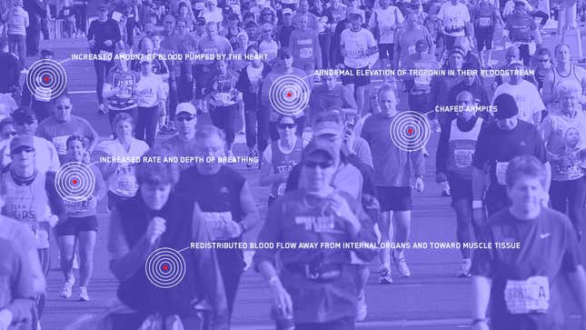Image for article titled The Terrifying Hell A Marathon Inflicts On The Human Body