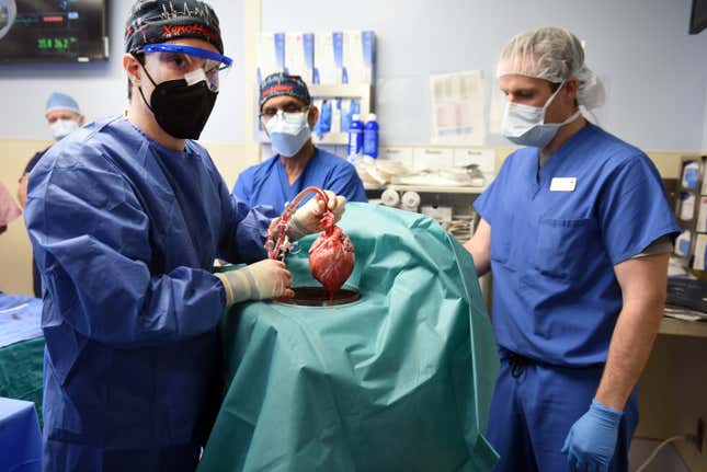 Four people in scrubs and PPE stand in an operating room. One is holding up a heart organ.