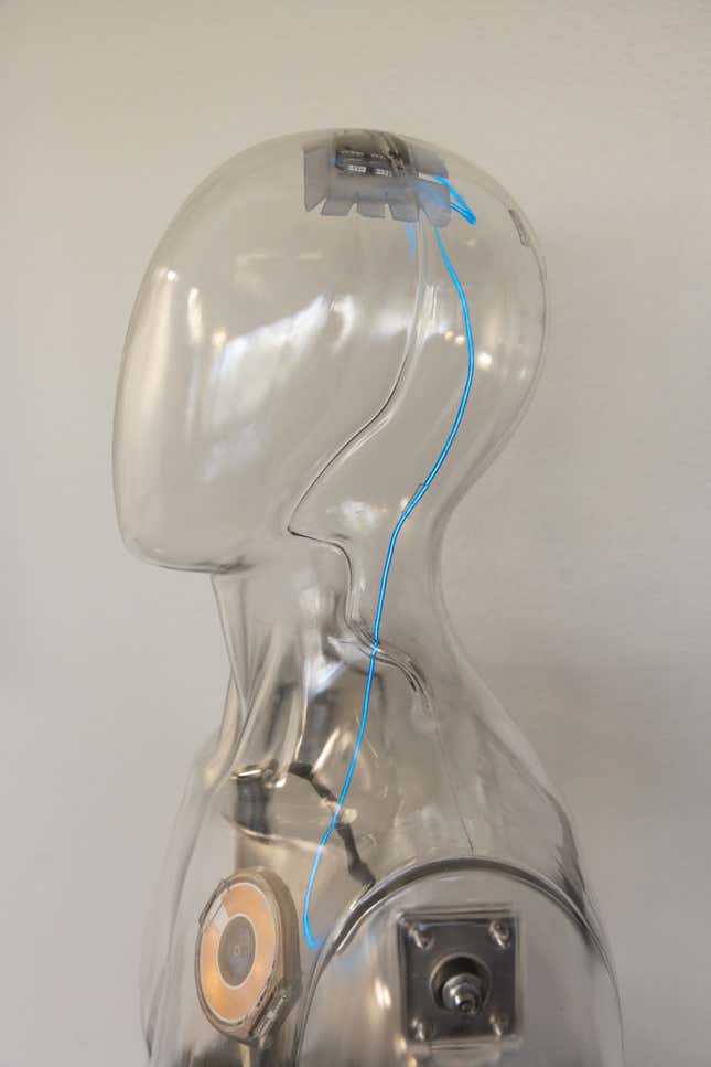 Image for article titled Elon Musk&#39;s Neuralink is getting more competition