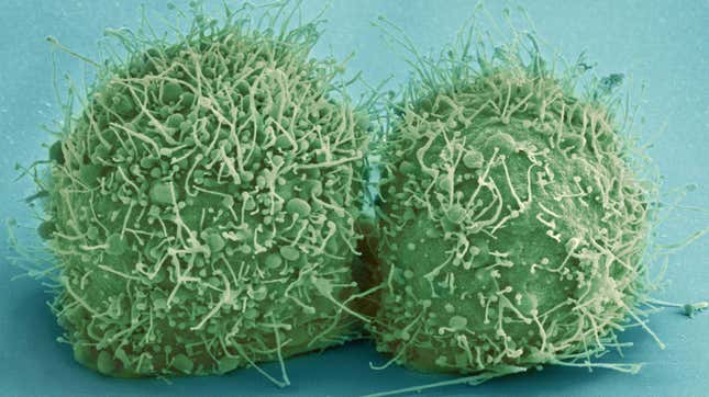 This undated microscope image made available by the National Center for Microscopy and Imaging Research shows just-divided HeLa cells. Until these cells came along, whenever human cells were put in a lab dish, they would die immediately or reproduce only a few times. Henrietta Lacks’ cells, by contrast, grew indefinitely. 