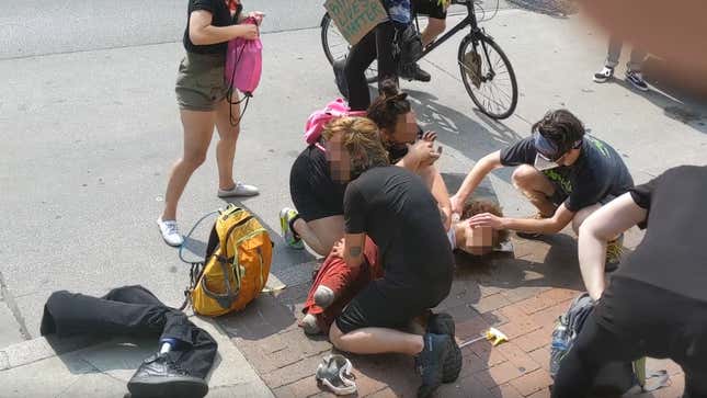 Image for article titled Police Tried to Take a Protester&#39;s Prosthetic Legs After Macing Him, Witnesses Say