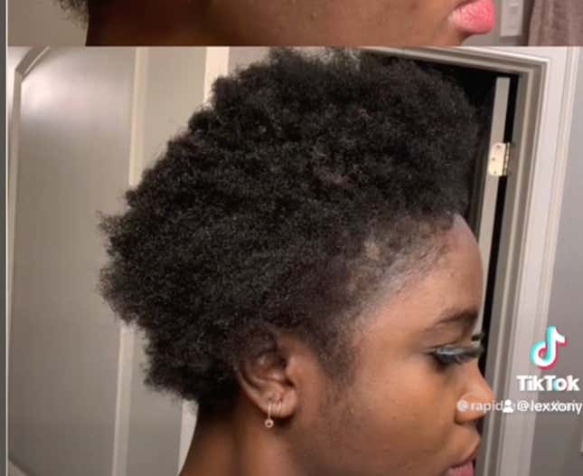 Image for article titled Black Women Are Using This Unusual Male Product to Regrow Their &#39;Edges&#39;