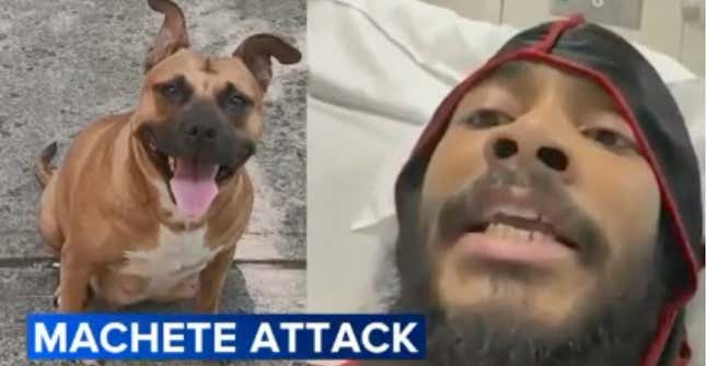 Image for article titled This Bronx Man Lost Four Fingers Protecting His Puppy From Who?!