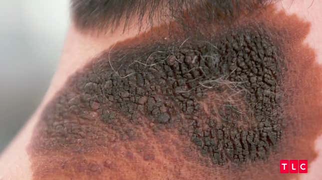 Image for article titled Dr. Pimple Popper Takes Us to Church