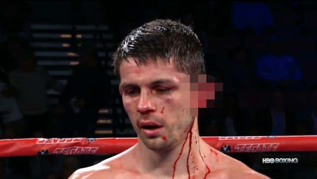 Bout Stopped After Boxer's Ear Nearly Torn Off