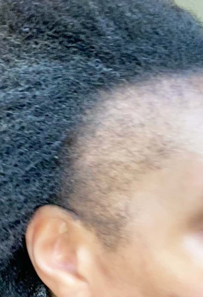 Image for article titled Black Women Are Using This Unusual Male Product to Regrow Their &#39;Edges&#39;