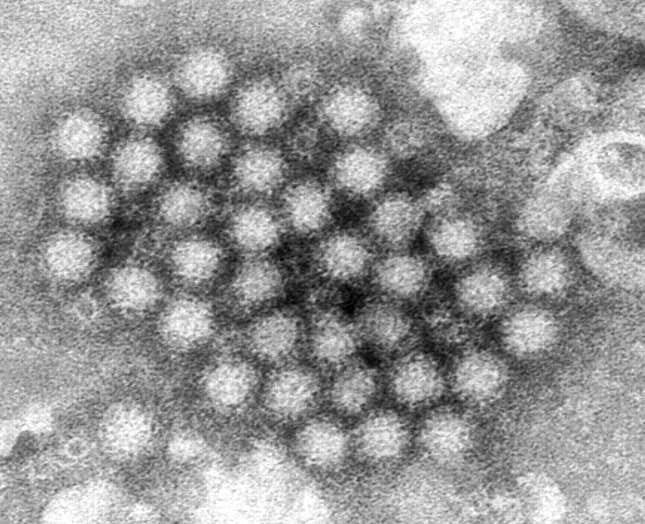 An electron microscope image of norovirus particles.