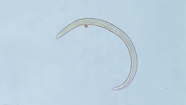 The rat lungworm (Angiostrongylus cantonensis) in one of its larval stages of life.
