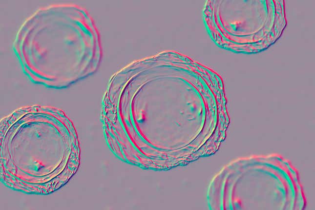 An illustration of fertilzed Ascaris lumbricoides eggs