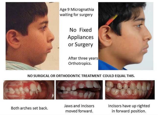 میو ادعا می کند که عکس های قبل و بعد از بیمارانش دلیلی بر این است که می توانید با تکنیک های او مشکلات دندان و صورت را اصلاح کنید.